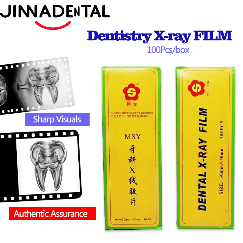 Medical Lab Images - ฟิล์มเอ็กซ์เรย์ทันตกรรมขนาด 30*40 มม. ฟิล์มภาพทางการแพทย์สำหรับช่องปาก ฟิล์มเอ็กซ์เรย์ดิจิตอล MSY